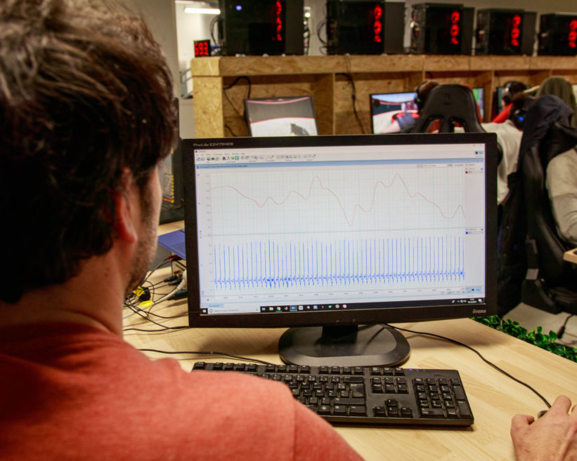 Contrôle qualité des signaux physiologiques enregistrés