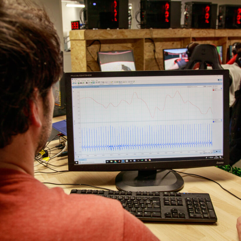 Contrôle qualité des signaux physiologiques enregistrés